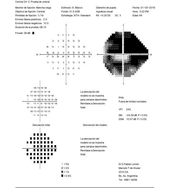 Campo Visual afectado por glaucoma